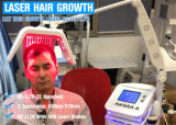Laser Hair Therapy Diode Laser Hair Growth Machine